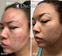 Load image into Gallery viewer, Omnilux Contour Face