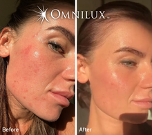 Load image into Gallery viewer, Omnilux Contour Face
